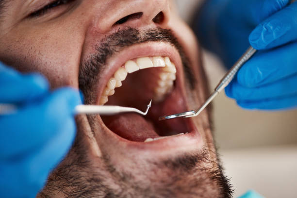 Best Emergency Denture Repair in Presquille, LA