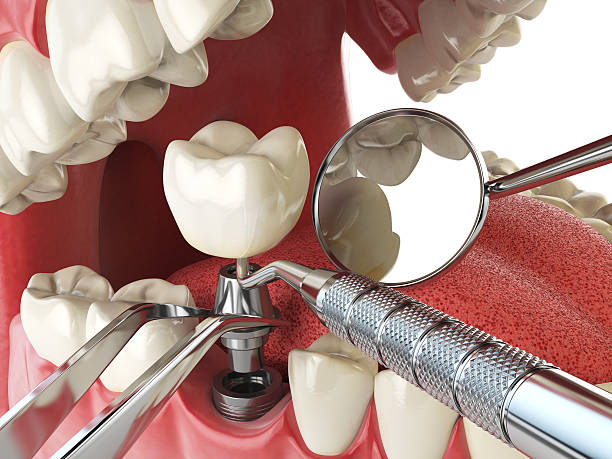 Best Emergency Gum Treatment in Presquille, LA